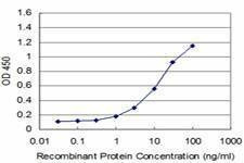 Anti-LIMK1 Antibody