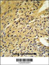 Anti-COQ5 (Center) Antibody