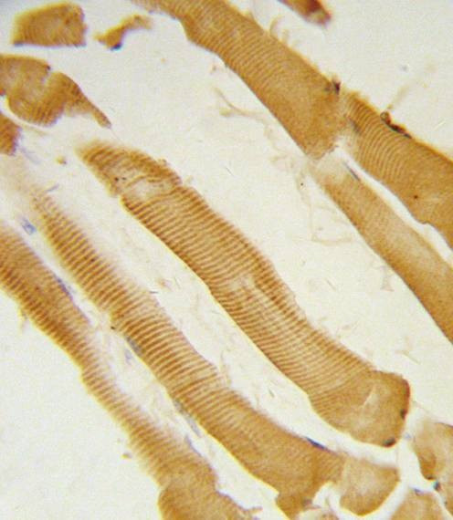 Anti-ITPKC (N-term) Antibody