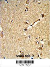 Anti-DLL3 (C-term) Antibody