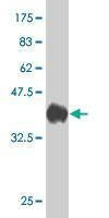Anti-LMBR1 Antibody