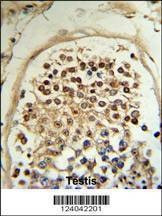 Anti-HCCA2 (N-term) Antibody