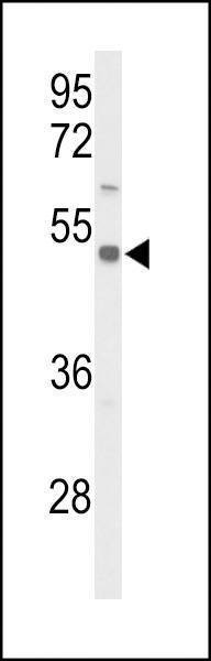 Anti-S39A8 (Center) Antibody