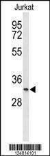 Anti-T150A (Center) Antibody