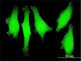 Anti-LMO1 Antibody