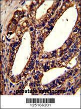 Anti-ORAI1 (Center) Antibody