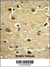 Anti-CROT (N-term) Antibody