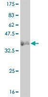 Anti-LMO2 Antibody