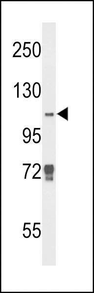 Anti-JMJD2B (N-term) Antibody