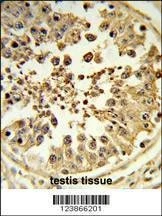 Anti-DIAPH2 (Center) Antibody
