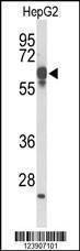Anti-FBXL5 (N-term) Antibody