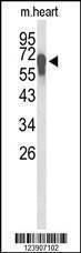 Anti-FBXL5 (N-term) Antibody