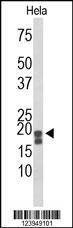 Anti-ACP1 (N-term) Antibody