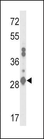 Anti-GSTA2 (N-term) Antibody