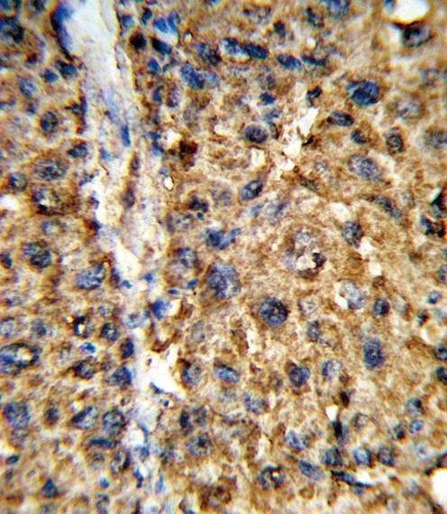 Anti-GSTA2 (N-term) Antibody