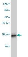 Anti-LMO3 Antibody