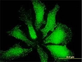 Anti-LMO3 Antibody