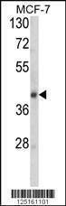 Anti-SERPINA9 (Center) Antibody