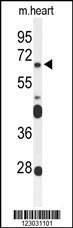 Anti-FZD4 (C-term) Antibody