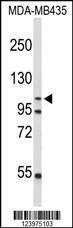 Anti-GEN1 (N-term) Antibody