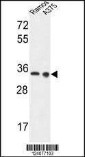 Anti-LDHA (Center) Antibody