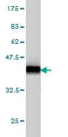 Anti-LNX2 Antibody