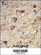 Anti-LRRC4 (C-term) Antibody