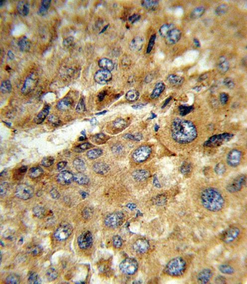Anti-TAT (Center) Antibody