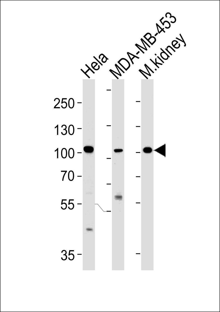 Anti-NCOA7 (N-term) Antibody