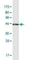 Anti-LOC285141 Antibody