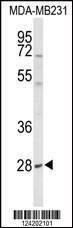 Anti-YIPF5 (N-term) Antibody