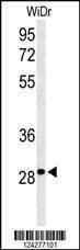 Anti-C9orf95 (N-term) Antibody