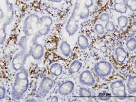 Anti-LRIT3 Antibody