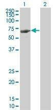 Anti-LRIT3 Antibody