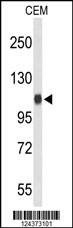 Anti-IPO11 (C-term) Antibody