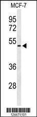 Anti-FLVC2 (C-term) Antibody