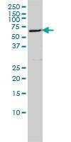 Anti-LSM16 Antibody