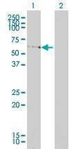 Anti-LSM16 Antibody