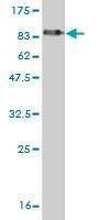 Anti-LSM16 Antibody