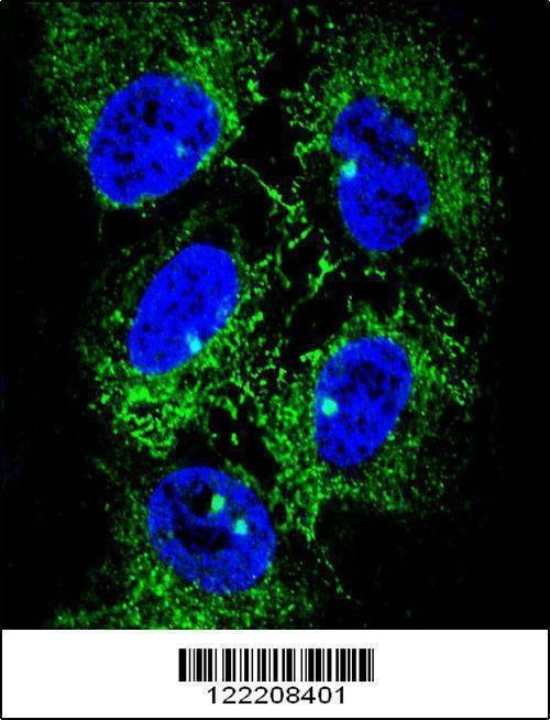 Anti-ADH7 (C-term) Antibody