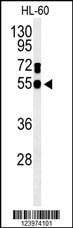 Anti-GDA (N-term) Antibody