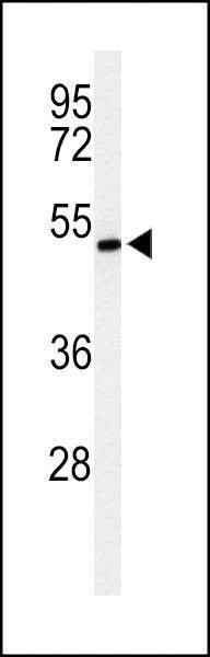 Anti-ZDHHC9 (C-term) Antibody
