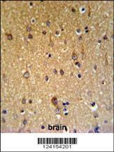 Anti-ZDHHC9 (C-term) Antibody