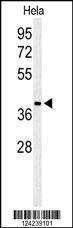 Anti-ADPRHL2 (N-term) Antibody