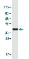 Anti-LXN Antibody
