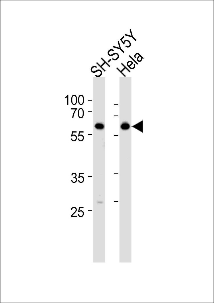 Anti-HDAC2 (Center) Antibody