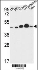Anti-NDUFS2 (Center) Antibody