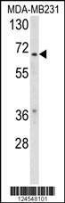 Anti-RXRB (Center) Antibody
