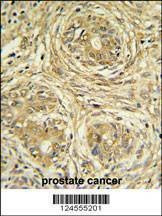 Anti-SUPV3L1 (N-term) Antibody