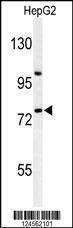 Anti-ZNF202 (Center) Antibody